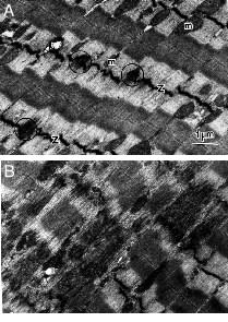 Electron micrograph of injured muscle
