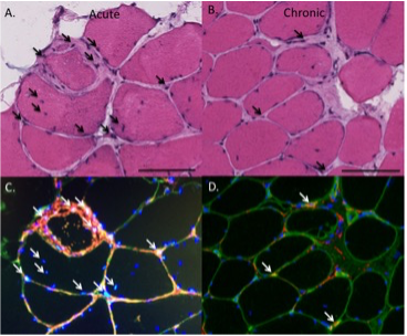 Example images of biopsy tissue