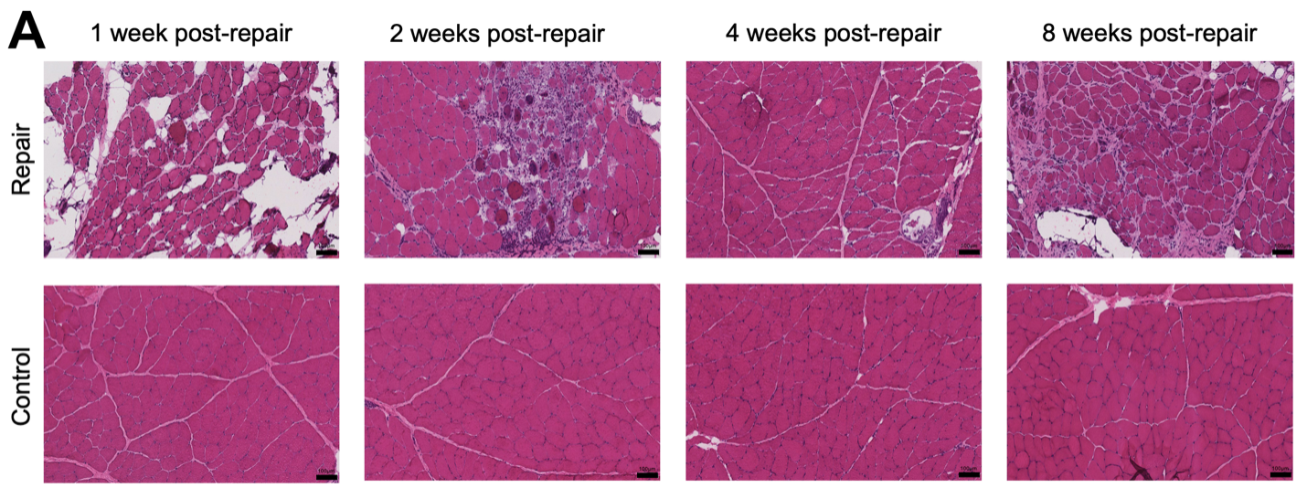 Panel of hematoxylin and eosin stained muscle cross-sections demonstrating tissue changes